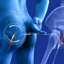 Orthopedics 214 Cauda Equina, Lumbar Radiculopathy, and Clinical Considerations image