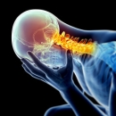 Neurology 202: Chiropractic Considerations of Pain on the Central Nervous System | Chiropractor Course Online image