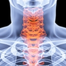 Case Studies & Clinical Pearls 208: The Cervical Spine II | Chiropractic Online CE  image
