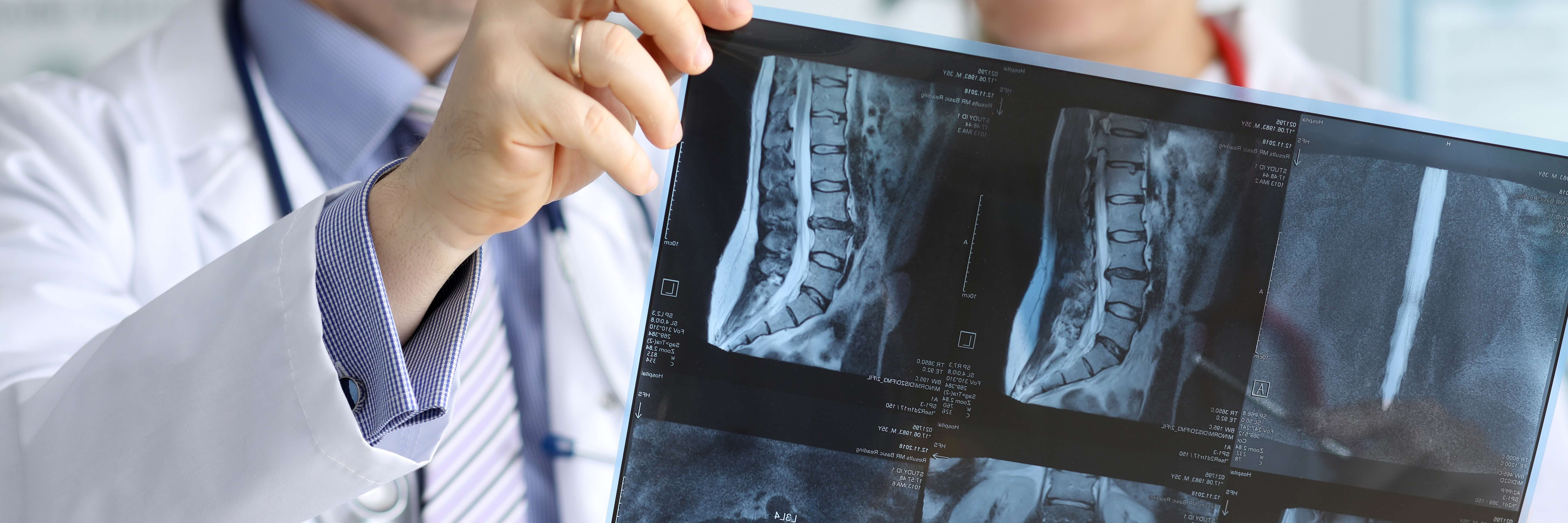 Inmage of chiropractor reading x-ray on our chiropractic onle continuing education courses page