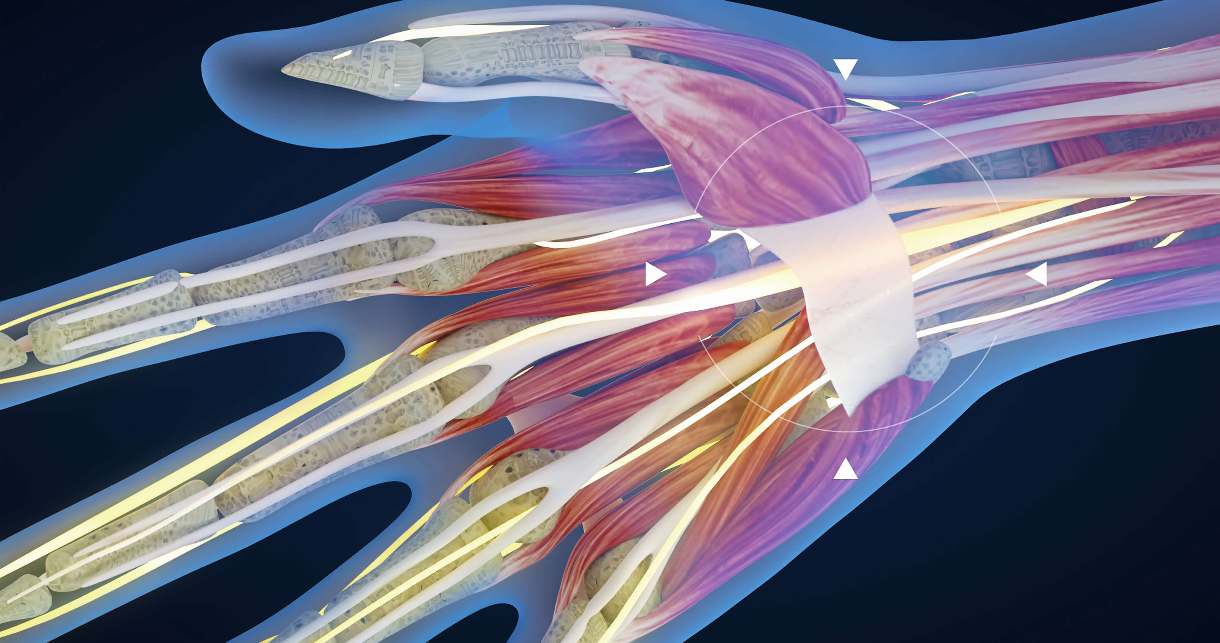 image of carpal tunnel syndrom on our chiropractic ceu page
