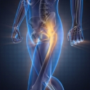 Sports Injuries 209: Sports Injuries of the Hip Region image