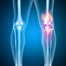 01/25/2022 Rehabilitation 313 - The Knee: Diagnosis & Rehabilitation image