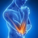 Sports Injuries 280: Upper Arm Conditions image